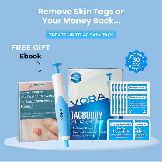 HeyTaggy™ – No More Skin Tags